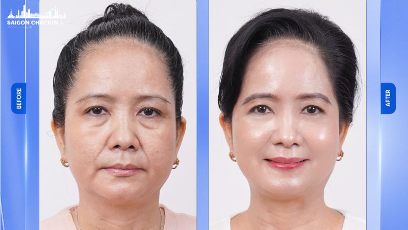 top-10-dia-chi-cang-da-mat-tphcm-10