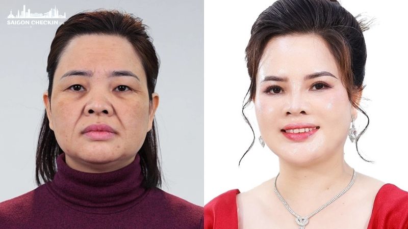 top-10-dia-chi-cang-da-mat-tphcm-5