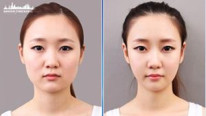 top-5-dia-chi-got-ham-v-line-tphcm-1