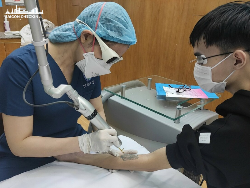 top-5-dia-chi-xoa-hinh-xam-tphcm-an-toan-khong-seo-uy-tin-1