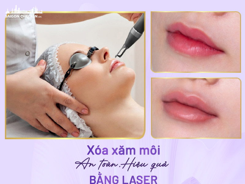 top-5-dia-chi-xoa-hinh-xam-tphcm-an-toan-khong-seo-uy-tin-3