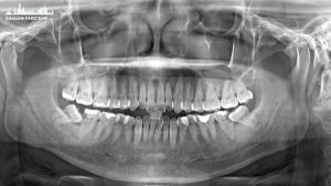 top-benh-vien-phong-kham-chup-x-quang-rang-tphcm-1