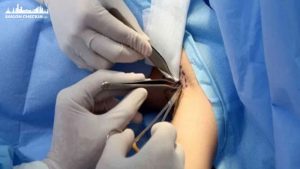 top-dia-chi-cat-tuyen-mo-hoi-nach-uy-tin-gia-tot-tphcm-2