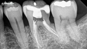 top-dia-chi-chua-tuy-rang-tphcm-3