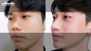 top-dia-chi-nang-mui-nam-tphcm-1