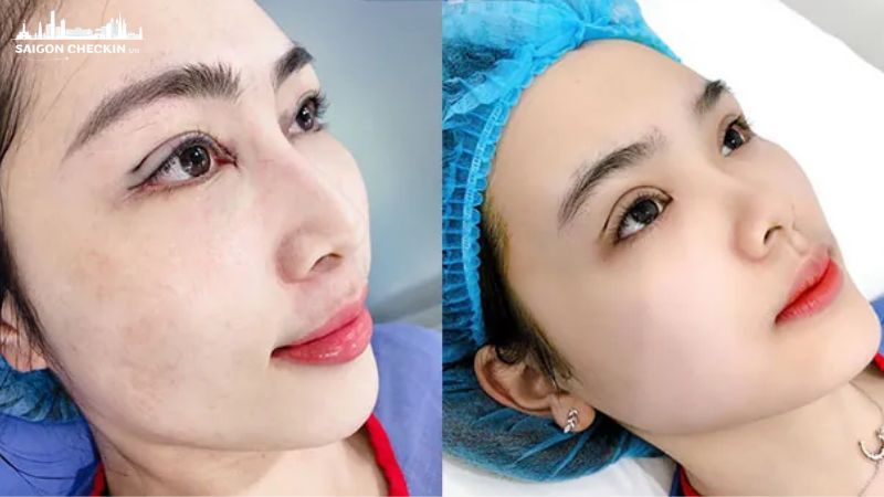 top-dia-chi-nhan-mi-han-quoc-dep-tu-nhien-uy-tin-tai-tphcm-1