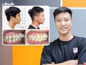 top-dia-chi-nieng-rang-sinh-vien-tphcm-uy-tin-gia-re-tra-gop-0-lai-suat-1