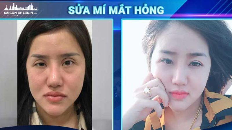 top-dia-chi-sua-mi-mat-hong-tphcm-dep-an-toan-uy-tin-3