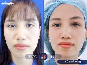 top-dia-chi-sua-mi-mat-hong-tphcm-dep-an-toan-uy-tin-4