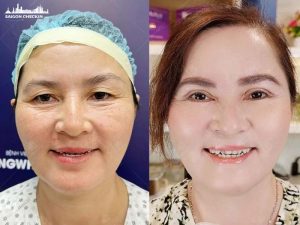 top-dia-chi-tiem-cang-bong-da-mat-tphcm-an-toan-gia-re-3