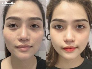 top-dia-chi-tiem-ha-tphcm-uy-tin-dep-tu-nhien-3