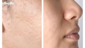 top-dia-chi-tri-seo-ro-seo-mun-uy-tin-tai-tphcm-9