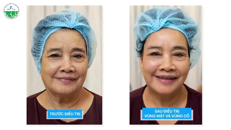 top-dia-chi-xoa-bot-bam-sinh-an-toan-uy-tin-tai-tphcm-1