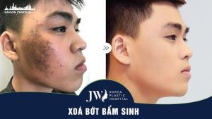 top-dia-chi-xoa-bot-bam-sinh-an-toan-uy-tin-tai-tphcm-2