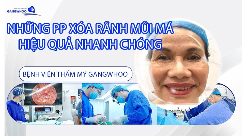 Bệnh viện Thẩm mỹ Gangwhoo – căng chỉ collagen xóa rãnh cười