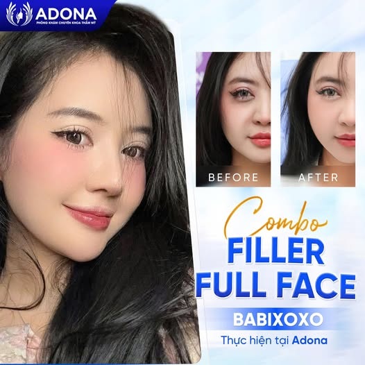 Thẩm mỹ viện ADONA – nổi bật với dịch vụ trẻ hóa không phẫu thuật