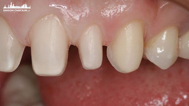 top-nha-khoa-boc-rang-su-tphcm-12