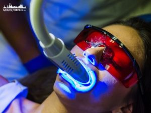 top-nha-khoa-tay-trang-rang-tphcm-uy-tin-khong-e-buot-2