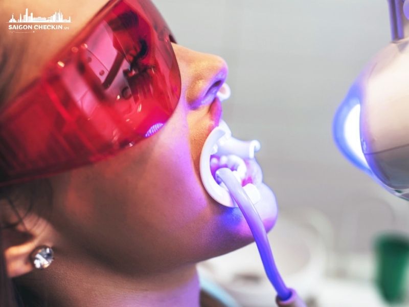 top-nha-khoa-tay-trang-rang-tphcm-uy-tin-khong-e-buot-4