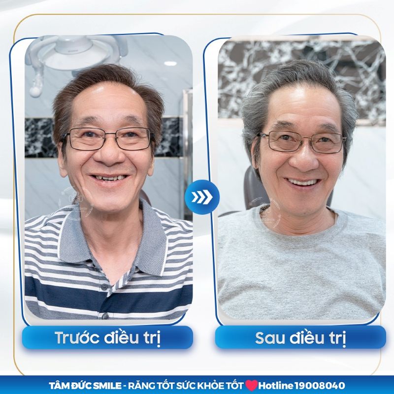 nha-khoa-tam-duc-smile-binh-phuoc-co-tot-khong-3