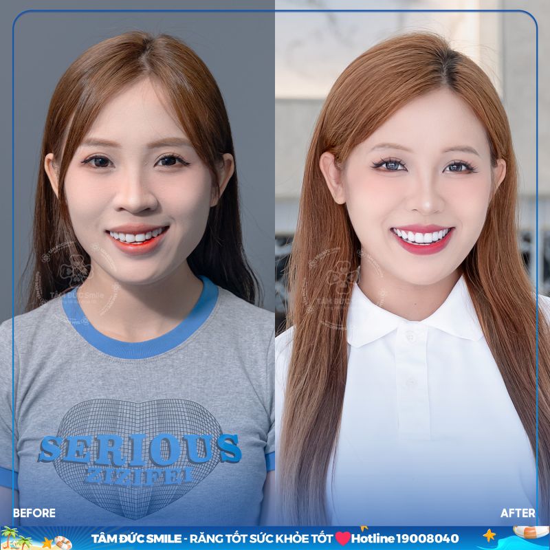 nha-khoa-tam-duc-smile-binh-phuoc-co-tot-khong-5