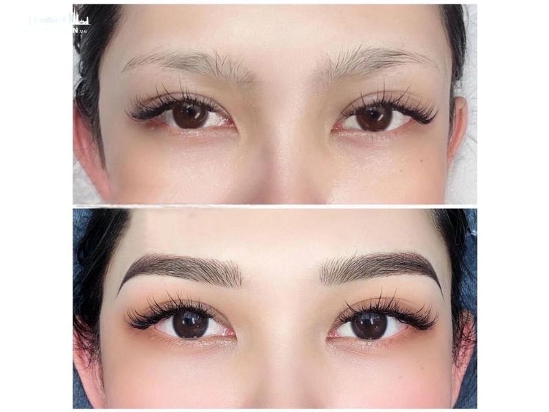 phun-xam-tham-my-thu-duc-1