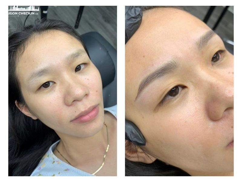 phun-xam-tham-my-thu-duc-3