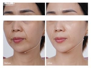 spa-tre-hoa-da-thu-duc-5