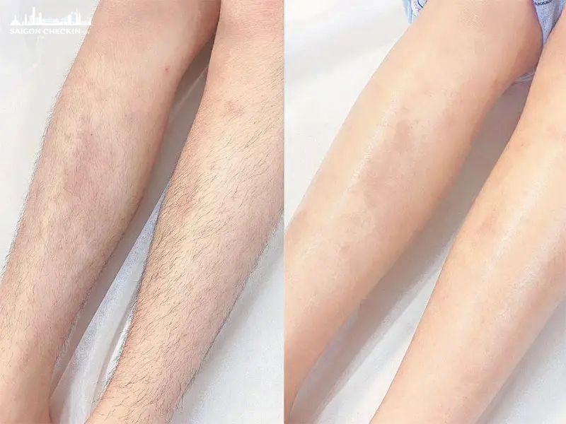 spa-triet-long-vinh-vien-thu-duc-2