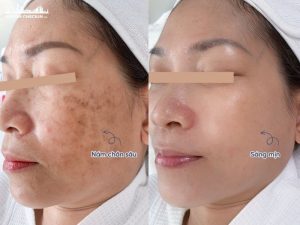 tri-nam-tan-nhang-thu-duc-1