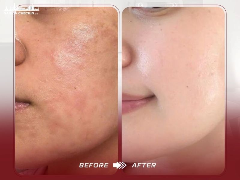 tri-nam-tan-nhang-thu-duc-3