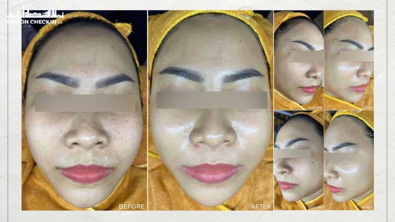 tri-nam-tan-nhang-thu-duc-5