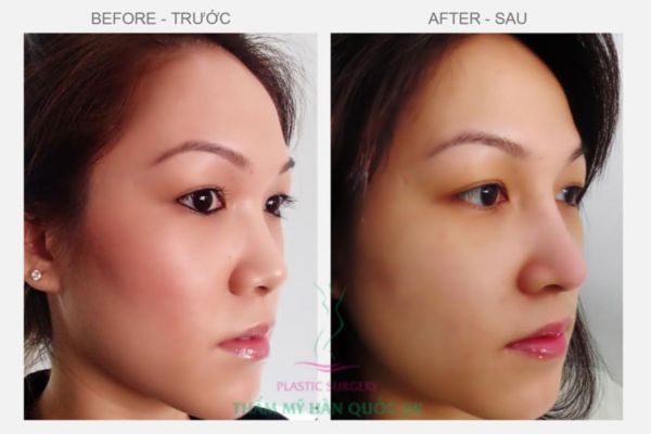 danh-sach-bac-si-nang-mui-duoc-viet-kieu-chon-tai-tphcm-uy-tin-noi-tieng-2