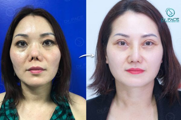 danh-sach-bac-si-nang-mui-duoc-viet-kieu-chon-tai-tphcm-uy-tin-noi-tieng-3