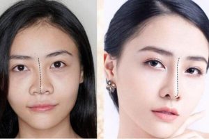 danh-sach-bac-si-nang-mui-duoc-viet-kieu-chon-tai-tphcm-uy-tin-noi-tieng-4