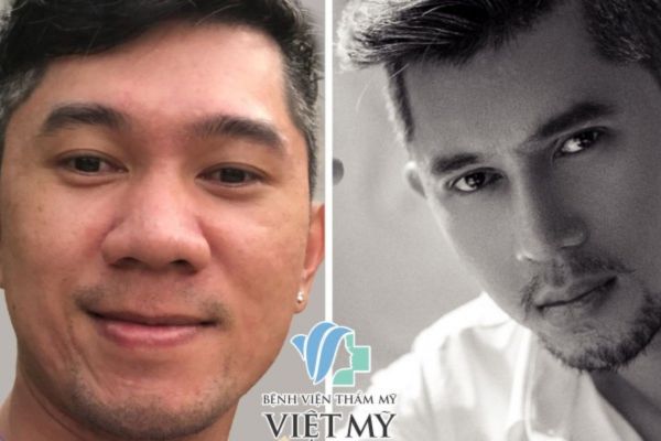 danh-sach-bac-si-nang-mui-duoc-viet-kieu-chon-tai-tphcm-uy-tin-noi-tieng-5