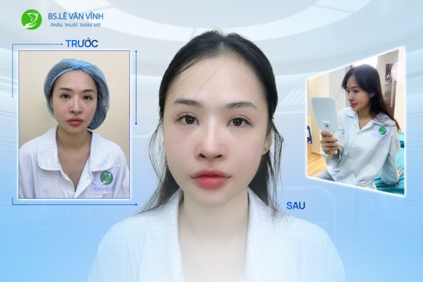 danh-sach-dia-chi-dap-khuyet-ho-canh-mui-o-tphcm-uy-tin-bac-si-gioi-2