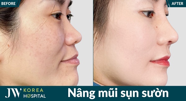 danh-sach-dia-chi-nang-mui-boc-sun-tphcm-uy-tin-review-tot-2