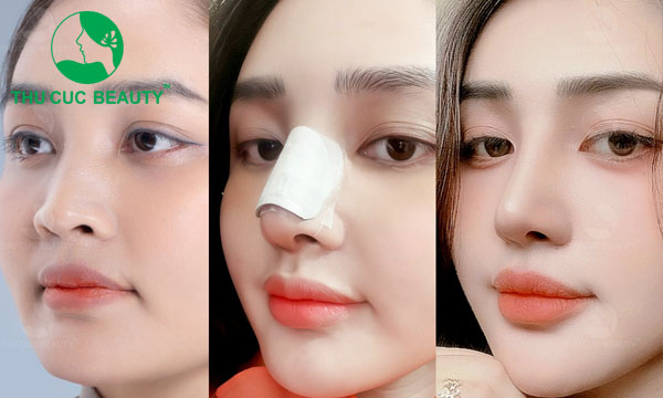 danh-sach-dia-chi-nang-mui-boc-sun-tphcm-uy-tin-review-tot-3