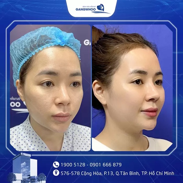 danh-sach-dia-chi-nang-mui-boc-sun-tphcm-uy-tin-review-tot-4