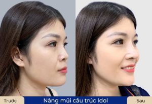 danh-sach-dia-chi-nang-mui-cau-truc-tphcm-uy-tin-dep-an-toan-nen-tham-khao-3