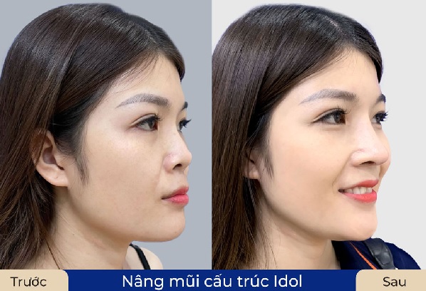 danh-sach-dia-chi-nang-mui-cau-truc-tphcm-uy-tin-dep-an-toan-nen-tham-khao-3