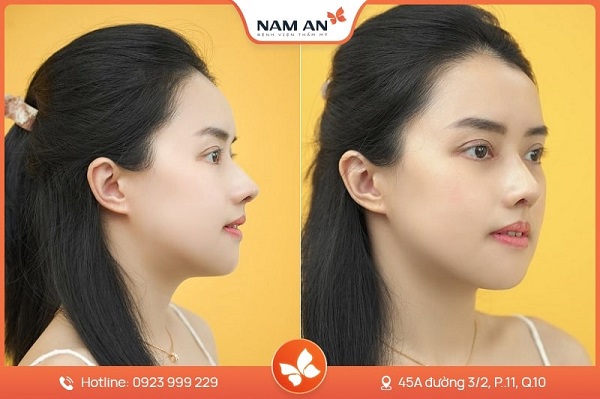 danh-sach-dia-chi-nang-mui-cau-truc-tphcm-uy-tin-dep-an-toan-nen-tham-khao-5