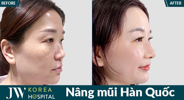 danh-sach-dia-chi-nang-mui-han-quoc-tphcm-uy-tin-dep-va-an-toan-1