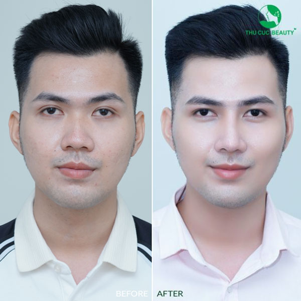 danh-sach-dia-chi-nang-mui-nam-tphcm-uy-tin-dep-tu-nhien-duoc-review-tot-4