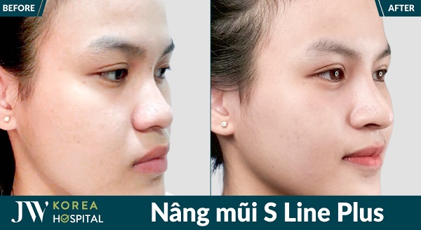 danh-sach-dia-chi-nang-mui-s-line-tphcm-uy-tin-dep-tu-nhien-nen-tham-khao-1