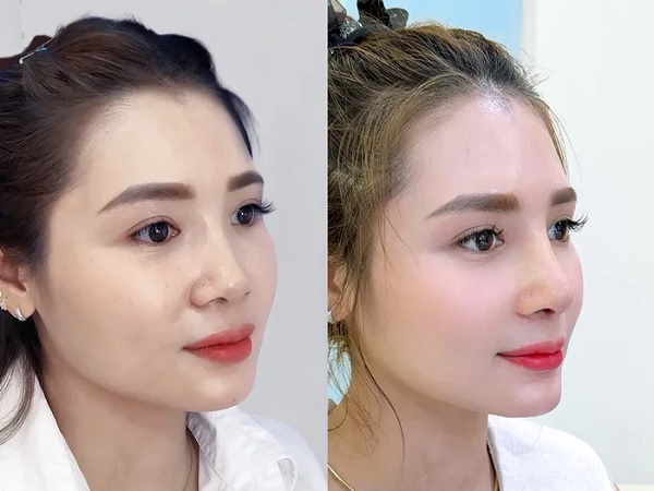 danh-sach-dia-chi-nang-mui-s-line-tphcm-uy-tin-dep-tu-nhien-nen-tham-khao-2