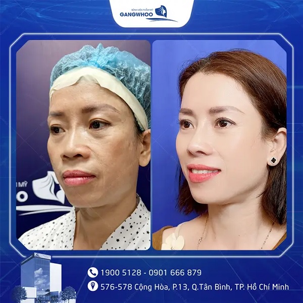 danh-sach-dia-chi-nang-mui-s-line-tphcm-uy-tin-dep-tu-nhien-nen-tham-khao-5