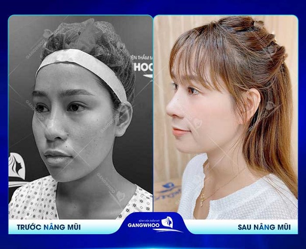 danh-sach-dia-chi-nang-mui-tphcm-uy-tin-dep-tu-nhien-an-toan-8