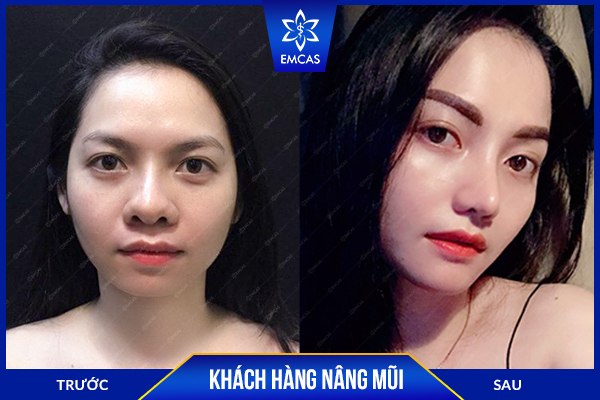 danh-sach-dia-chi-nang-mui-tphcm-uy-tin-dep-tu-nhien-an-toan-9